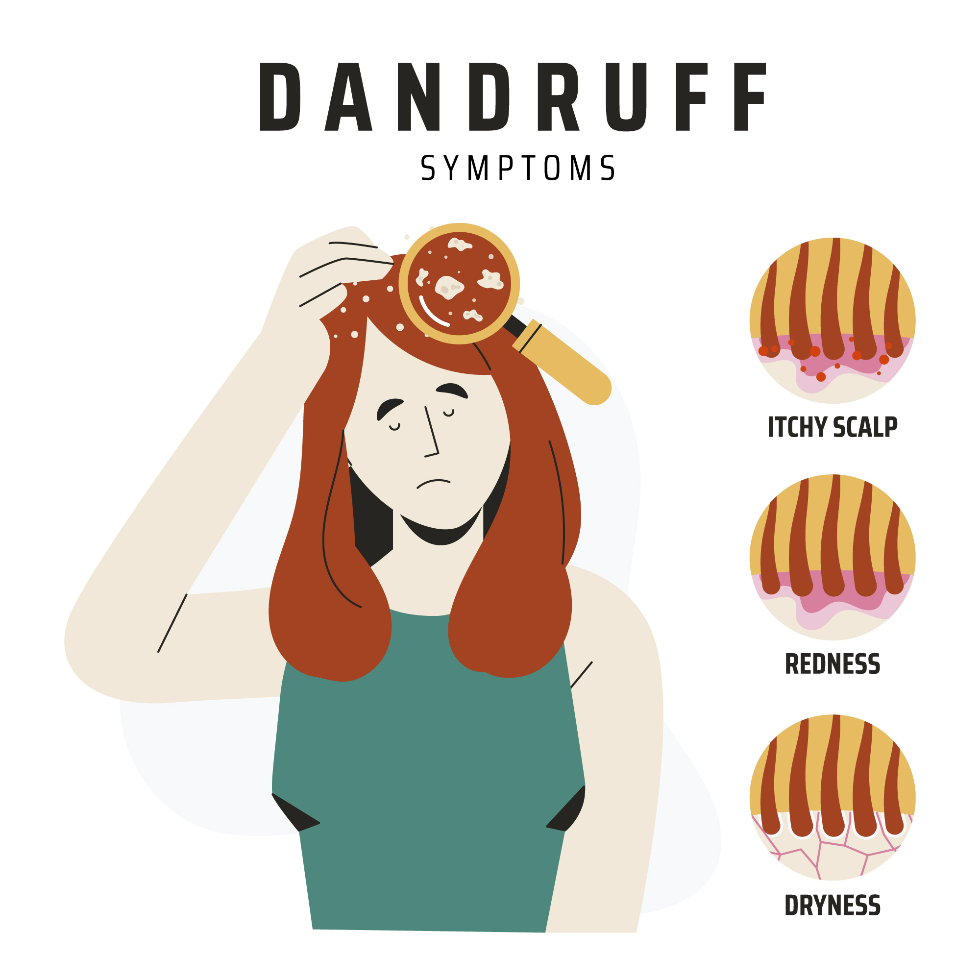 Dandruff hair detail