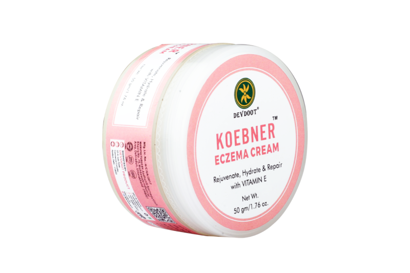 Koebner Eczema Cream - DEVDOOT PRODUCT